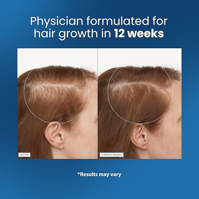 Bodywise Rosemary Hair Growth Serum Roll